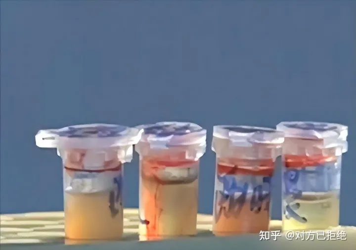 05年郑州大叔偶遇陌生人 萍水相逢竟一模一样DNA鉴定让医生意外