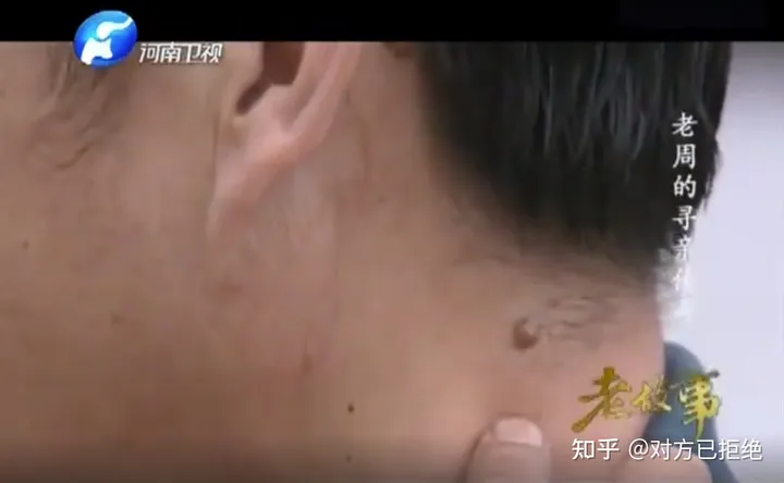 05年郑州大叔偶遇陌生人 萍水相逢竟一模一样DNA鉴定让医生意外