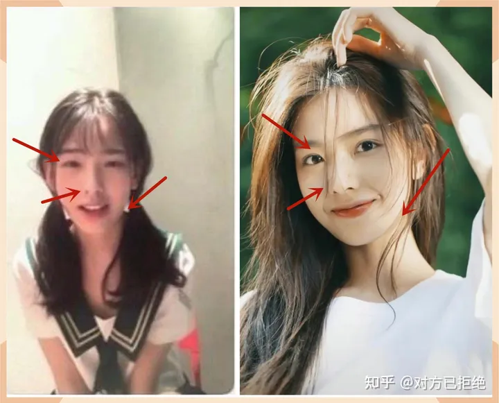 网红孙一宁整过容吗 对比旧照颜值变化大 曾拒还奢侈包引争议